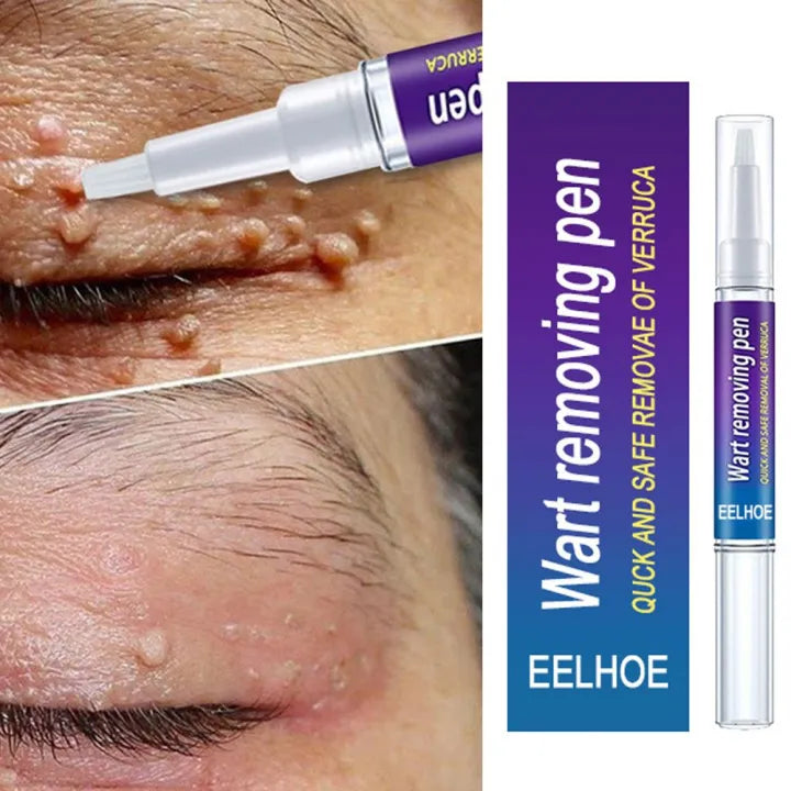 Wart Removing Gel, Remove Wart - Tag Mole Remover