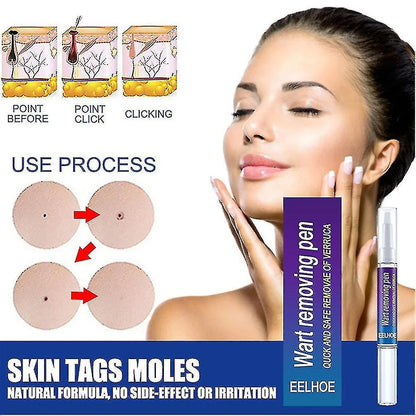 Wart Removing Gel, Remove Wart - Tag Mole Remover