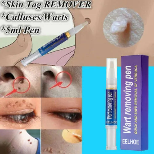 Wart Removing Gel, Remove Wart - Tag Mole Remover